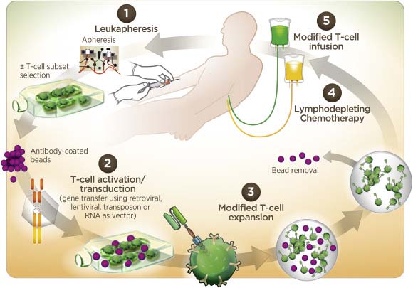 The main process of CAR-T therapy