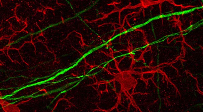 Microglia Morphology