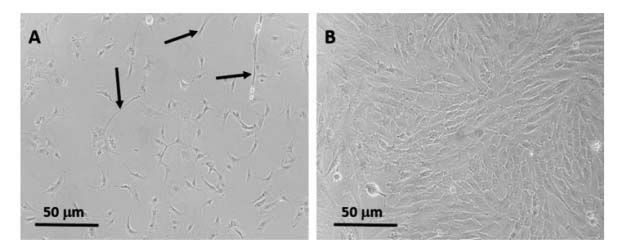 Fibroblast removal from ATII cultures