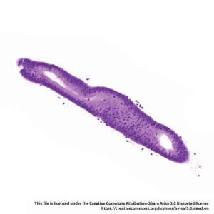 Human Endometrial Epithelial Cells