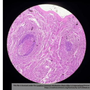 Human Spleen Cells