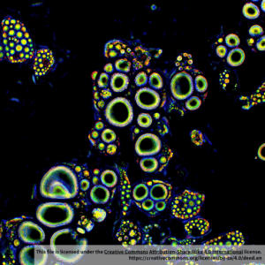 Human Preadipocytes-Visceral