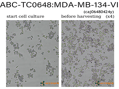 MDA-MB-134-VI