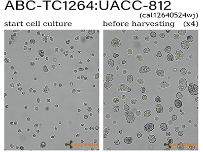 UACC-812