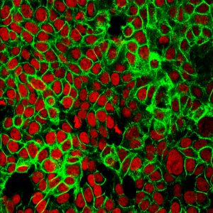 Human Colorectal Tumor Carcinoma Associated Fibroblasts