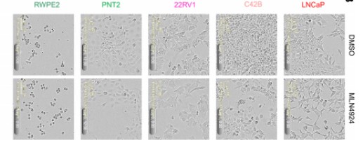 All cells were treated with vehicle or 0.1 μM MLN4924 for 72 h