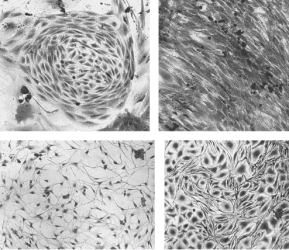 other contaminating cell types in the culture