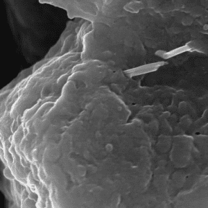 Immortalized Human Alveolar Epithelial Cell Line