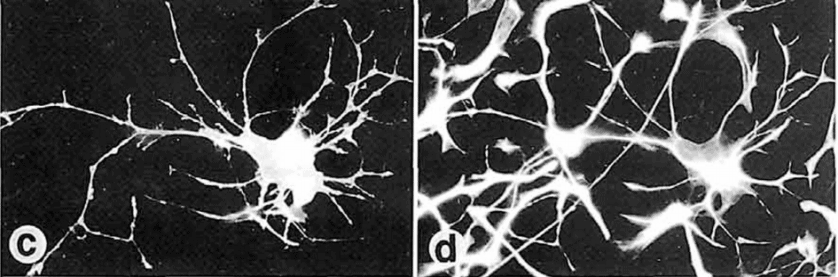 Fetal human brain cell cultures