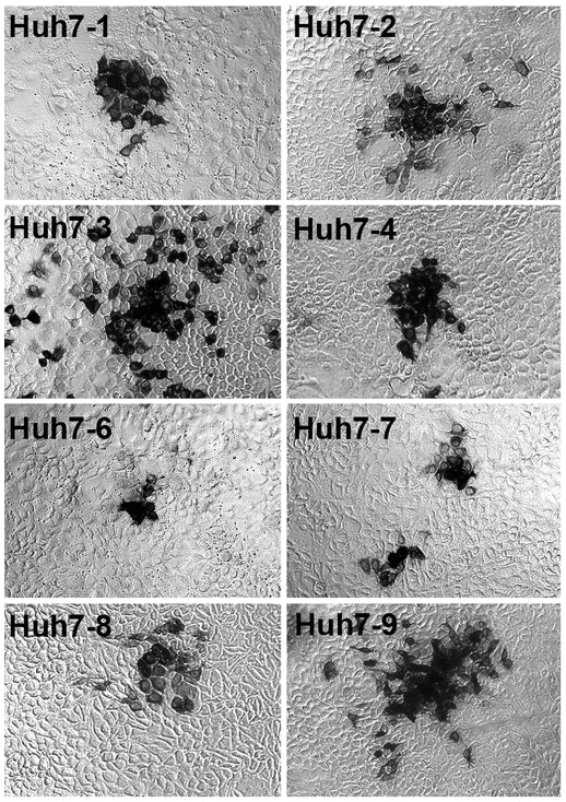 Huh-7 Cell Lines infected by Hepatitis C Virus