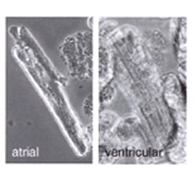 Culture of Human Cardiomyocytes and its Applications in Drug Discovery and Research