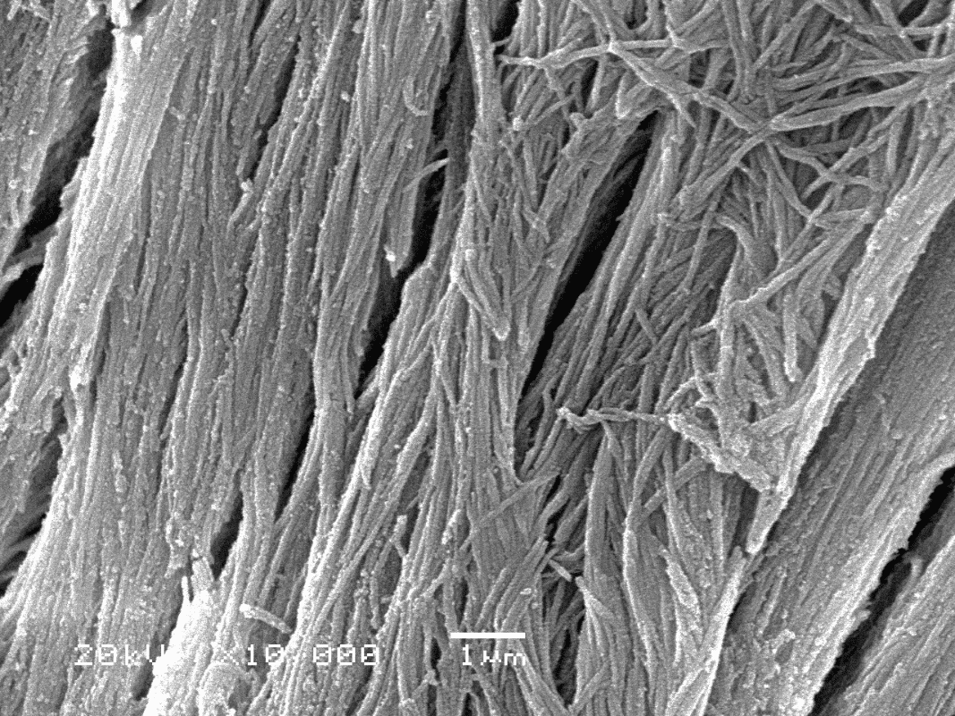 Microstructure of bone tissue