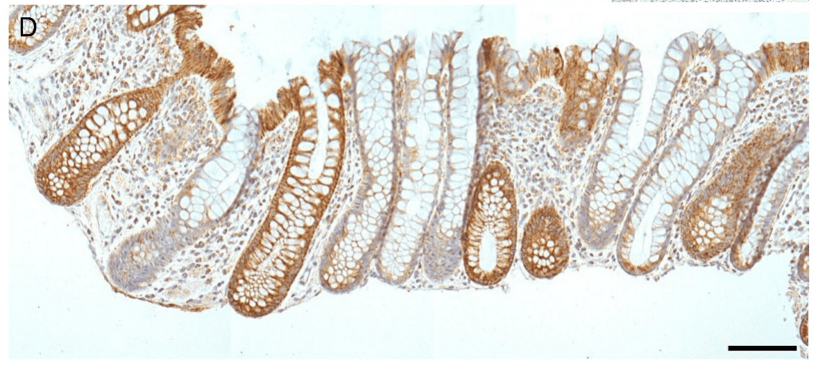 Human Colonic Epithelial Cells and Colon Diseases