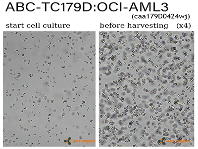 OCI-AML3